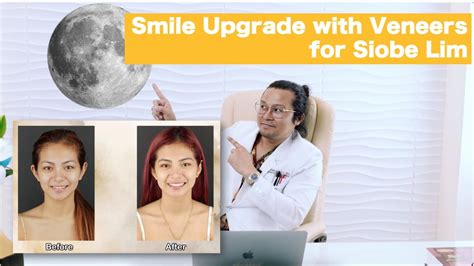 siobe lim before and after|Siobe Lim Reels .